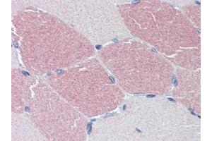 Human Skeletal Muscle: Formalin-Fixed, Paraffin-Embedded (FFPE) (STK39 Antikörper  (C-Term))