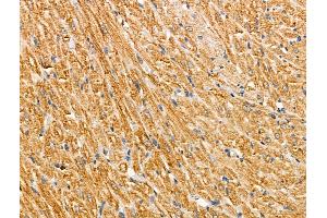 ABIN6257763 and ABIN6274933 at 1/100 staining Rat heart tissue by IHC-P.