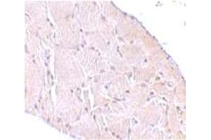 Immunohistochemical staining of human skeletal muscle tissue with 10 ug/mL WNT10A polyclonal antibody . (WNT10A Antikörper  (C-Term))