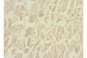 Immunohistochemistry of paraffin-embedded human heart tissue using ABIN7149412 at dilution of 1:100 (PLA2G4C Antikörper  (AA 1-189))