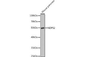 Western blot analysis of extracts of mouse pancreas, using NDP52 antibody (ABIN6131368, ABIN6137860, ABIN6137861 and ABIN6223210) at 1:1000 dilution. (CALCOCO2 Antikörper  (AA 137-446))