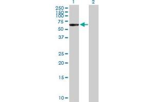 Western Blot analysis of CTNNA3 expression in transfected 293T cell line by CTNNA3 MaxPab polyclonal antibody. (CTNNA3 Antikörper  (AA 1-516))