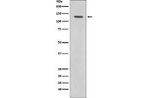 Western blot analysis of Rad21 expression in HeLa cell lysate.