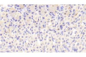Detection of NT in Mouse Stomach Tissue using Polyclonal Antibody to Neurotensin (NT) (Neurotensin Antikörper  (AA 42-167))