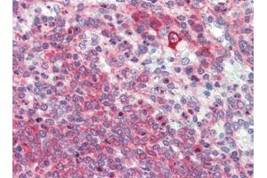 Human Spleen (formalin-fixed, paraffin-embedded) stained with LXNfollowed by biotinylated goat anti-rabbit IgG secondary antibody, alkaline phosphatase-streptavidin and chromogen. (Latexin Antikörper  (Center))