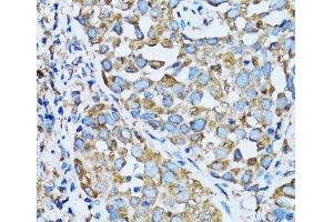 Immunohistochemistry (Paraffin-embedded Sections) (IHC (p)) image for anti-alpha Ketoglutarate Dehydrogenase (alphaKGDHC) antibody (ABIN7011083)