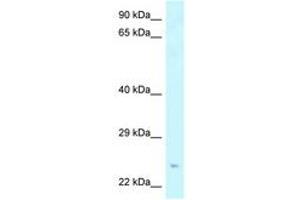 Image no. 1 for anti-Syntaxin Binding Protein 6 (Amisyn) (STXBP6) (N-Term) antibody (ABIN6747678) (STXBP6 Antikörper  (N-Term))