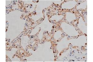Immunohistochemistry (IHC) image for anti-V-Yes-1 Yamaguchi Sarcoma Viral Related Oncogene Homolog (LYN) (pTyr507) antibody (ABIN6256754)