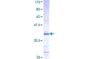 CAPN11 Protein (AA 557-651) (GST tag)