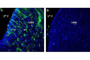 Expression of GPR139 in rat ventromedial hypothalamus (VMH). (G Protein-Coupled Receptor 139 (GPR139) Peptid)