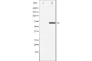 Western blot analysis of ZAP-70 phosphorylation expression in Jurkat whole cell lysates,The lane on the left is treated with the antigen-specific peptide. (ZAP70 Antikörper  (pTyr493))