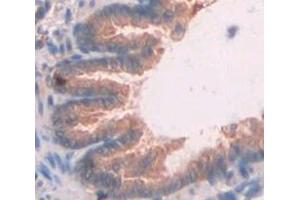 IHC-P analysis of Rat Tissue, with DAB staining. (CXCL11 Antikörper  (AA 22-100))