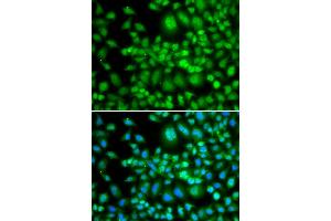 Immunofluorescence analysis of MCF-7 cells using SETD5 antibody (ABIN4905135). (SETD5 Antikörper)