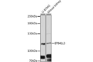 Western blot analysis of extracts of various cell lines, using EPB41L3 antibody (ABIN6127807, ABIN6140201, ABIN6140202 and ABIN6216501) at 1:3000 dilution. (EPB41L3 Antikörper  (AA 656-865))