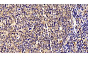 Detection of S100A8 in Porcine Lymph node Tissue using Polyclonal Antibody to S100 Calcium Binding Protein A8 (S100A8) (S100A8 Antikörper  (AA 1-89))