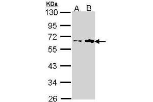WB Image Sample (30 ug of whole cell lysate) A: H1299 B: Hela 10% SDS PAGE antibody diluted at 1:1000 (Fukutin Antikörper)