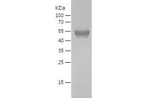 Western Blotting (WB) image for Cardiac Troponin T (cTnT) (AA 2-190) protein (His-IF2DI Tag) (ABIN7122150) (Cardiac Troponin T2 Protein (AA 2-190) (His-IF2DI Tag))