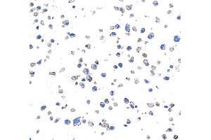 Immunocytochemistry (ICC) image for anti-CD28 (CD28) (AA 170-220) antibody (ABIN7455122) (Rekombinanter CD28 Antikörper  (AA 170-220))