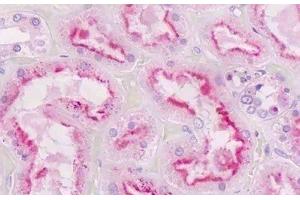 Immunohistochemistry (IHC) image for anti-Guanine Nucleotide Binding Protein (G Protein), Q Polypeptide (GNAQ) (AA 52-78) antibody (ABIN2604103)