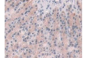 IHC-P analysis of Rat Stomach Tissue, with DAB staining. (Glucocorticoid Receptor Antikörper  (AA 564-733))