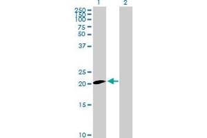 Claudin 20 Antikörper  (AA 1-219)