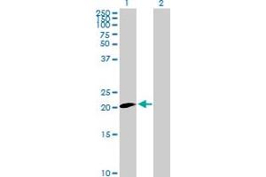 Western Blot analysis of CLDN20 expression in transfected 293T cell line by CLDN20 MaxPab polyclonal antibody. (Claudin 20 Antikörper  (AA 1-219))
