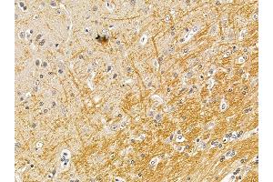 ABIN7094689 and ABIN7098740 at 1/100 staining rat brain tissue by IHC-P. (Ras Protein-Specific Guanine Nucleotide-Releasing Factor 2 (RASGRF2) (N-Term) Antikörper)