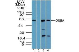 Image no. 2 for anti-OTU Domain Containing 5 (OTUD5) (AA 550-600) antibody (ABIN960300) (OTUD5 Antikörper  (AA 550-600))