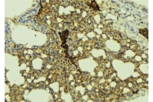 ABIN6277404 at 1/100 staining Mouse lung tissue by IHC-P. (ABCC1 Antikörper  (N-Term))