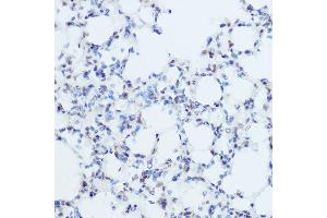 Immunohistochemistry (IHC) image for anti-Thyroid Hormone Receptor, alpha (THRA) (AA 100-200) antibody (ABIN6149127)