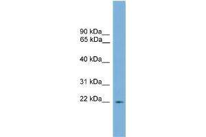 WB Suggested Anti-Rgs10 Antibody Titration: 0. (RGS10 Antikörper  (N-Term))