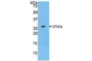 Detection of Recombinant COL1a1, Human using Polyclonal Antibody to Collagen Type I Alpha 1 (COL1a1) (COL1A1 Antikörper  (AA 253-471))