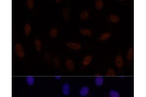 Immunofluorescence analysis of U-2 OS cells using GLI2 Polyclonal Antibody at dilution of 1:100.