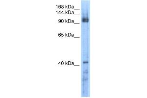 WB Suggested Anti-RECQL5 Antibody Titration:  0. (RECQL5 Antikörper  (Middle Region))