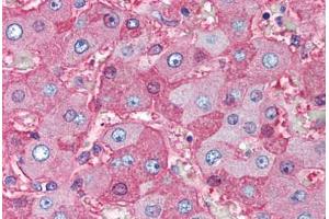 Human Liver (formalin-fixed, paraffin-embedded) stained with Albumin antibody ABIN291153 at 5 ug/ml followed by biotinylated anti-mouse IgG secondary antibody ABIN481714, alkaline phosphatase-streptavidin and chromogen. (Albumin Antikörper)