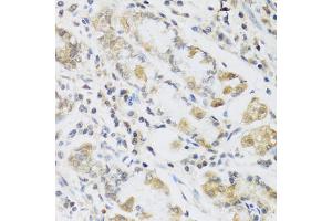 Immunohistochemistry of paraffin-embedded human stomach using RETN antibody (ABIN5974977) at dilution of 1/100 (40x lens).