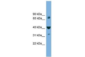 Western Blotting (WB) image for anti-Vacuolar Protein Sorting-Associated Protein 16 Homolog (VPS16) (Middle Region) antibody (ABIN2787354)