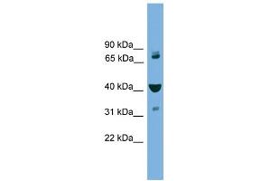 WB Suggested Anti-VPS16 Antibody Titration: 0. (VPS16 Antikörper  (Middle Region))