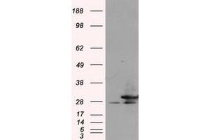 Image no. 3 for anti-Replication Protein A2, 32kDa (RPA2) antibody (ABIN1500739) (RPA2 Antikörper)
