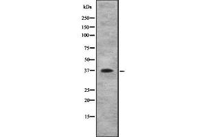 Western blot analysis IL10RB using COLO205 whole cell lysates (IL10RB Antikörper  (C-Term))