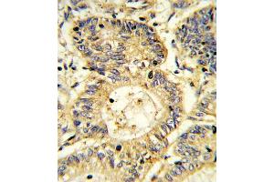 Immunohistochemistry (Paraffin-embedded Sections) (IHC (p)) image for anti-Suppressor of Cytokine Signaling 1 (SOCS1) (AA 35-66), (N-Term) antibody (ABIN652738)