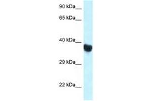 Image no. 1 for anti-Homeobox A10 (HOXA10) (C-Term) antibody (ABIN6747342)