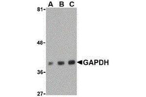 Western Blotting (WB) image for anti-Glyceraldehyde-3-Phosphate Dehydrogenase (GAPDH) (C-Term) antibody (ABIN2473758) (GAPDH Antikörper  (C-Term))
