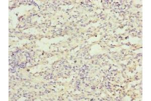 Immunohistochemistry of paraffin-embedded human spleen tissue using ABIN7152484 at dilution of 1:100 (FBXL5 Antikörper  (AA 1-310))