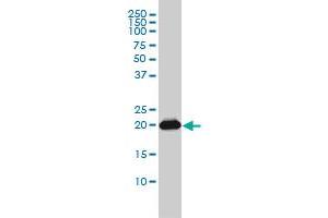 RAP2B monoclonal antibody (M01), clone 4F12-3C6 Western Blot analysis of RAP2B expression in A-431 . (RAP2B Antikörper  (AA 1-183))