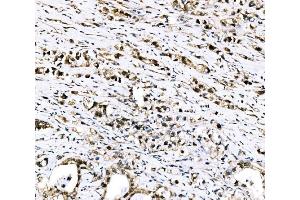 IHC analysis of RRS1 using anti-RRS1 antibody (ABIN7601344). (RRS1 Antikörper  (AA 33-266))