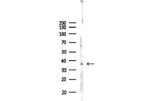 Western blot analysis of lysates from 293 cells(UV 30 min treatment), using ANP32E Antibody at 1/1000 dilution.