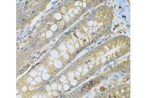 Immunohistochemistry (Paraffin-embedded Sections) (IHC (p)) image for anti-serpin Peptidase Inhibitor, Clade A (Alpha-1 Antiproteinase, Antitrypsin), Member 6 (SERPINA6) antibody (ABIN7008381)