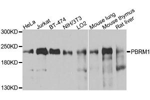 Western blot analysis of extracts of various cell lines, using PBRM1 antibody. (Polybromo 1 Antikörper)
