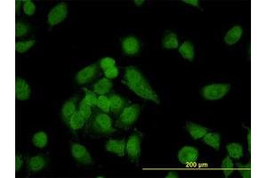 Image no. 4 for anti-Non-SMC Condensin I Complex, Subunit D2 (NCAPD2) (AA 1240-1339) antibody (ABIN599100) (NCAPD2 Antikörper  (AA 1240-1339))